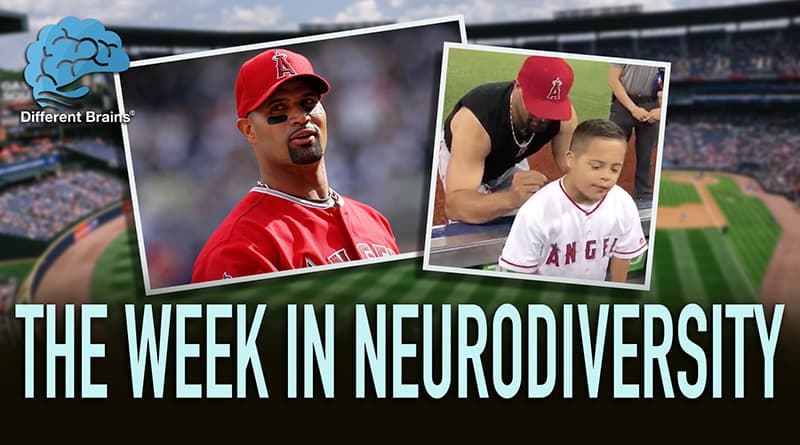 How MLB Star Albert Pujols Made The Day Of A Fan With Down Syndrome