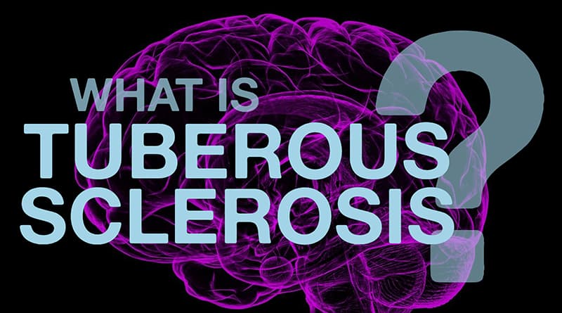 Cover Image - What Is Tuberous Sclerosis?