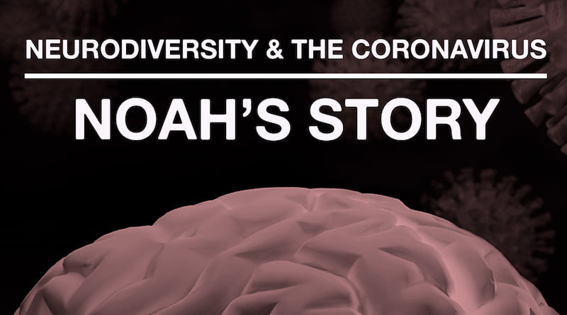 Featured Brain Image For Noah's Story.